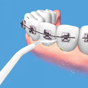 <span class="entry-title-primary">Global Dental Water Jet Forecast By 2019-2025 -Planet Market Reports</span> <span class="entry-subtitle">Global Dental Water Jet Market Research:</span>