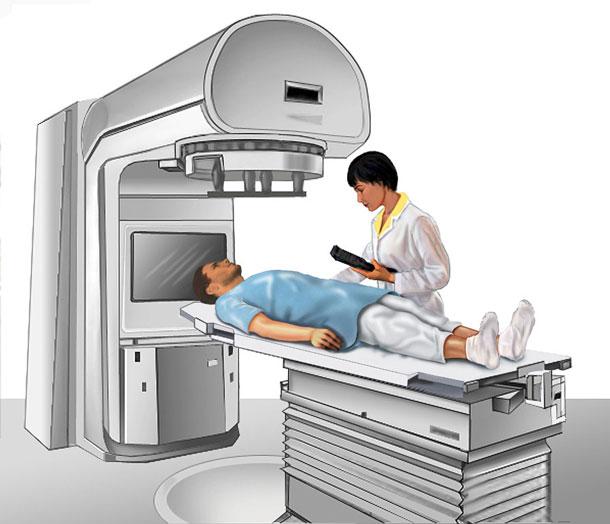 <span class="entry-title-primary">External Beam Radiotherapy Market Modest Situation Among and Market Share 2025</span> <span class="entry-subtitle">Global External Beam Radiotherapy Market Research:</span><span class="rating-result after_title mr-filter rating-result-24735">	<span class="mr-star-rating">			    <i class="fa fa-star mr-star-full"></i>	    	    <i class="fa fa-star mr-star-full"></i>	    	    <i class="fa fa-star mr-star-full"></i>	    	    <i class="fa fa-star mr-star-full"></i>	    	    <i class="fa fa-star mr-star-full"></i>	    </span><span class="star-result">	5/5</span>			<span class="count">				(2)			</span>			</span>