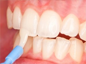 <span class="entry-title-primary">Fluoride Varnish Market Major Manufacturers, Trends, Demand, Share Analysis To 2025</span> <span class="entry-subtitle">Global Fluoride Varnish Market Research:</span>