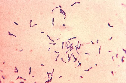 Gram Staining Market Size, Growth, Trends and Forecast 2019-2024<span class="rating-result after_title mr-filter rating-result-25249">			<span class="no-rating-results-text">No ratings yet.</span>		</span>