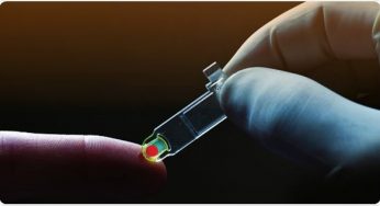 Global HbA1c Testing Device Market Analysis by Region and Future Trends till 2025