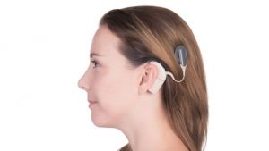 <span class="entry-title-primary">Hearing Implants Market Analysis, Key Manufacturers, Sales, Demand and Forecasts 2025</span> <span class="entry-subtitle">Global Hearing Implants Market Research:</span>