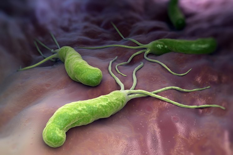 <span class="entry-title-primary">Helicobacter Pylori Testing Market 2019 Global Industry – Key Players, Size, Trends,Growth Analysis and Forecast to 2025</span> <span class="entry-subtitle">Global Helicobacter Pylori Testing Market Research:</span><span class="rating-result after_title mr-filter rating-result-24291">	<span class="mr-star-rating">			    <i class="fa fa-star mr-star-full"></i>	    	    <i class="fa fa-star mr-star-full"></i>	    	    <i class="fa fa-star mr-star-full"></i>	    	    <i class="fa fa-star mr-star-full"></i>	    	    <i class="fa fa-star mr-star-full"></i>	    </span><span class="star-result">	5/5</span>			<span class="count">				(1)			</span>			</span>