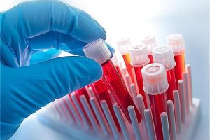 Hematology Analyzers & Reagents Market forecast to 2024 examined in new market research report