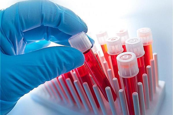 Hematology Analyzers & Reagents Market forecast to 2024 examined in new market research report<span class="rating-result after_title mr-filter rating-result-22598">			<span class="no-rating-results-text">No ratings yet.</span>		</span>