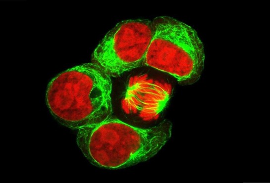 <span class="entry-title-primary">Hematopoietic Stem Cells (HSCs) Market Research Report 2019-2025 | Latest Trend, Growth And Forecast</span> <span class="entry-subtitle">Global Hematopoietic Stem Cells HSCs Market Research:</span><span class="rating-result after_title mr-filter rating-result-24255">	<span class="mr-star-rating">			    <i class="fa fa-star mr-star-full"></i>	    	    <i class="fa fa-star mr-star-full"></i>	    	    <i class="fa fa-star mr-star-full"></i>	    	    <i class="fa fa-star mr-star-full"></i>	    	    <i class="fa fa-star mr-star-full"></i>	    </span><span class="star-result">	5/5</span>			<span class="count">				(1)			</span>			</span>