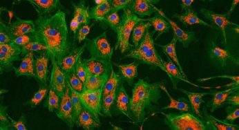 Live Cell Imaging Market Size, Growth, Trends Forecast 2019-2026