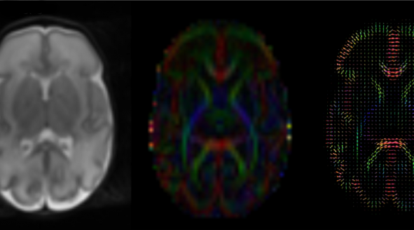 <span class="entry-title-primary">Medical Imaging Analysis Market: Global, Trends, Share, Industry Size, Growth, Forecast To 2024</span> <span class="entry-subtitle">Global Medical Imaging Analysis Market</span><span class="rating-result after_title mr-filter rating-result-26289">	<span class="mr-star-rating">			    <i class="fa fa-star mr-star-full"></i>	    	    <i class="fa fa-star mr-star-full"></i>	    	    <i class="fa fa-star mr-star-full"></i>	    	    <i class="fa fa-star mr-star-full"></i>	    	    <i class="fa fa-star mr-star-full"></i>	    </span><span class="star-result">	5/5</span>			<span class="count">				(1)			</span>			</span>