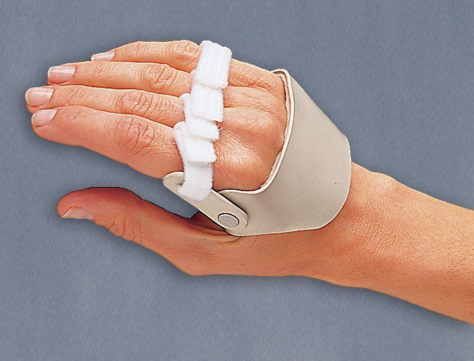 <span class="entry-title-primary">Metacarpal Splints Market Growth, Size, Analysis, Outlook by 2019 – Trends, Opportunities and Forecast to 2025</span> <span class="entry-subtitle">Global Metacarpal Splints Market Growth</span><span class="rating-result after_title mr-filter rating-result-25078">	<span class="mr-star-rating">			    <i class="fa fa-star mr-star-full"></i>	    	    <i class="fa fa-star mr-star-full"></i>	    	    <i class="fa fa-star mr-star-full"></i>	    	    <i class="fa fa-star mr-star-full"></i>	    	    <i class="fa fa-star mr-star-full"></i>	    </span><span class="star-result">	5/5</span>			<span class="count">				(1)			</span>			</span>