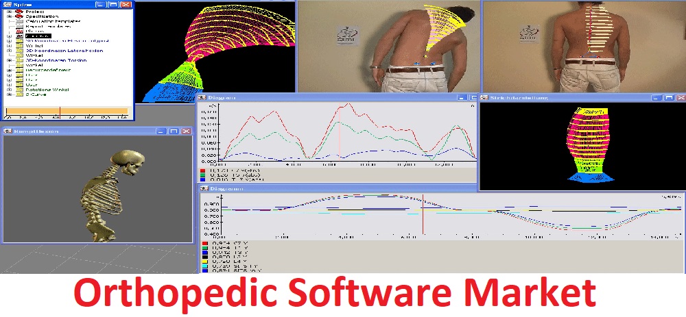 <span class="entry-title-primary">Orthopedic Software Market Size, Share Industry Analysis Forecast 2026</span> <span class="entry-subtitle">Orthopedic Software Market Size, Outlook, Growth, Trends and Forecasts 2026</span><span class="rating-result after_title mr-filter rating-result-26576">			<span class="no-rating-results-text">No ratings yet.</span>		</span>