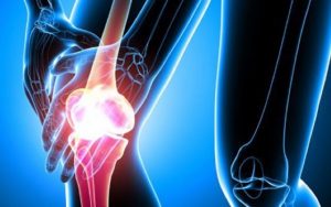 <span class="entry-title-primary">Global Osteoarthritis OA Market Size, Share, Growth, Top Key Players and 2028</span> <span class="entry-subtitle">Osteoarthritis OA Market Analysis 2019 (By Segment, Key Players and Applications) </span>