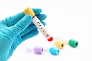 <span class="entry-title-primary">Global PSA Testing Market – Analysis, Share, Trends, Growth Forecast 2019</span> <span class="entry-subtitle">PSA Test Market Research; Report</span>