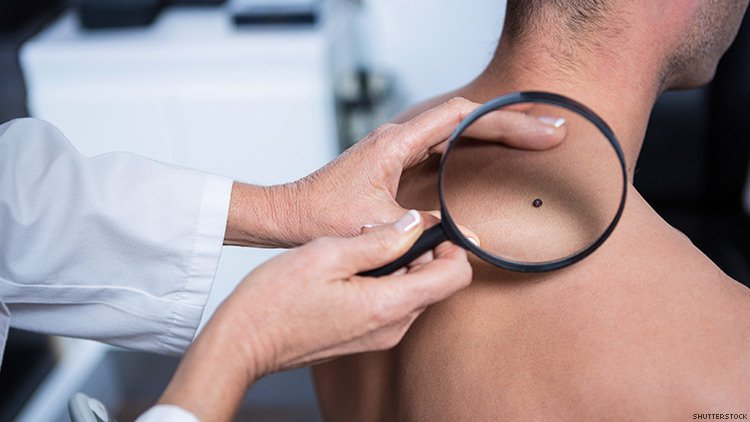 <span class="entry-title-primary">Skin Cancer Market 2019 | Manufacturers, Regions, Type and Application, Forecast to 2028</span> <span class="entry-subtitle">Global Skin Cancer Market Report Summary</span><span class="rating-result after_title mr-filter rating-result-21516">	<span class="mr-star-rating">			    <i class="fa fa-star mr-star-full"></i>	    	    <i class="fa fa-star mr-star-full"></i>	    	    <i class="fa fa-star mr-star-full"></i>	    	    <i class="fa fa-star mr-star-full"></i>	    	    <i class="fa fa-star mr-star-full"></i>	    </span><span class="star-result">	5/5</span>			<span class="count">				(1)			</span>			</span>