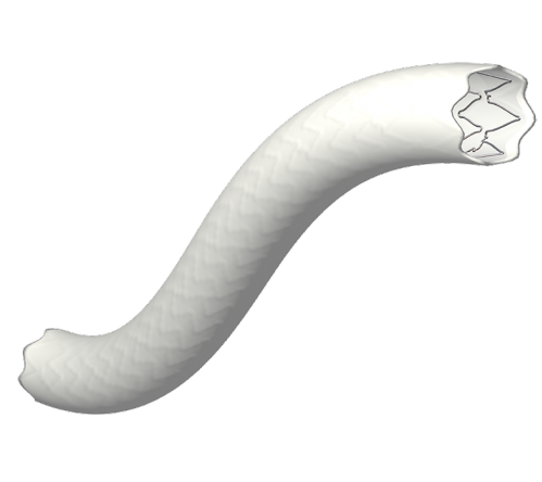 <span class="entry-title-primary">Global Stent Grafts Market Research analysis and Forecast, Technology</span> <span class="entry-subtitle">Stent Grafts Market Research Size and Forecast, 2019</span><span class="rating-result after_title mr-filter rating-result-26645">	<span class="mr-star-rating">			    <i class="fa fa-star mr-star-full"></i>	    	    <i class="fa fa-star mr-star-full"></i>	    	    <i class="fa fa-star mr-star-full"></i>	    	    <i class="fa fa-star mr-star-full"></i>	    	    <i class="fa fa-star mr-star-full"></i>	    </span><span class="star-result">	5/5</span>			<span class="count">				(2)			</span>			</span>