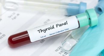 Global Thyroid Function Tests Market Size, Share, Trends, CAGR Status, Growth, Share | Industry Report, 2024