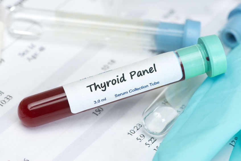 Global Thyroid Function Tests Market Size, Share, Trends, CAGR Status, Growth, Share | Industry Report, 2024<span class="rating-result after_title mr-filter rating-result-22781">			<span class="no-rating-results-text">No ratings yet.</span>		</span>