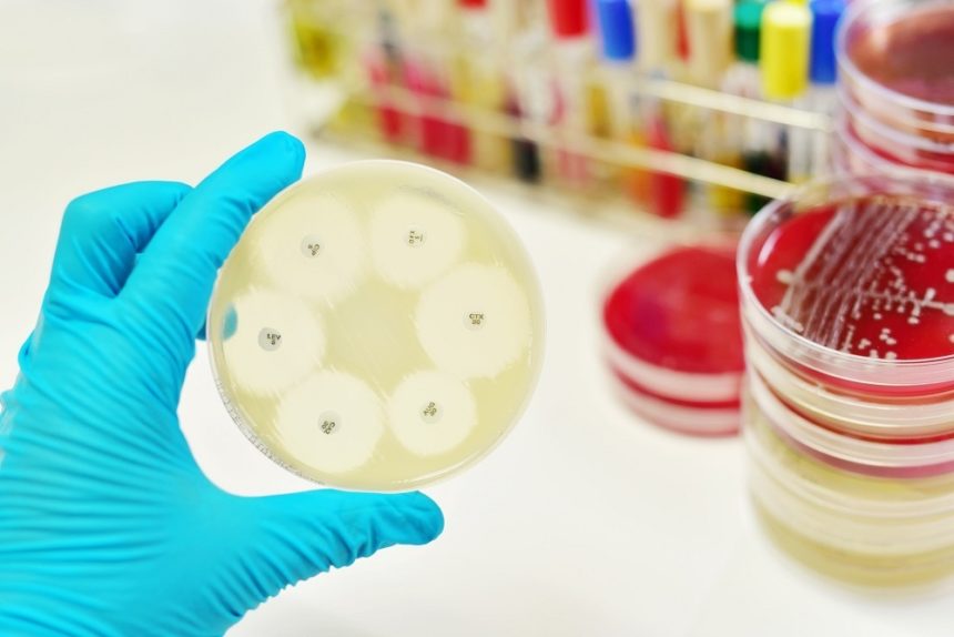 <span class="entry-title-primary">Antimicrobial Susceptibility Testing Market Report On And United States Market</span> <span class="entry-subtitle">Antimicrobial Susceptibility Testing Market Growth: Factors to 2019</span><span class="rating-result after_title mr-filter rating-result-28894">	<span class="mr-star-rating">			    <i class="fa fa-star mr-star-full"></i>	    	    <i class="fa fa-star mr-star-full"></i>	    	    <i class="fa fa-star mr-star-full"></i>	    	    <i class="fa fa-star mr-star-full"></i>	    	    <i class="fa fa-star mr-star-full"></i>	    </span><span class="star-result">	5/5</span>			<span class="count">				(1)			</span>			</span>