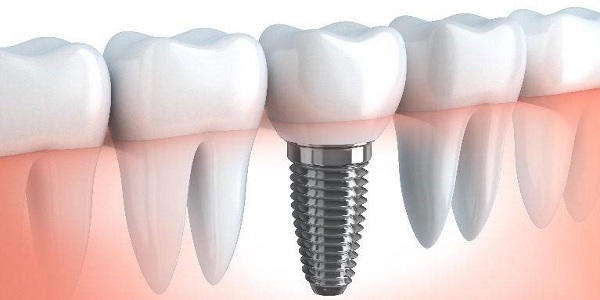 Bio-Implants Market Size, Growth, Trends, Share and Analysis<span class="rating-result after_title mr-filter rating-result-29833">			<span class="no-rating-results-text">No ratings yet.</span>		</span>