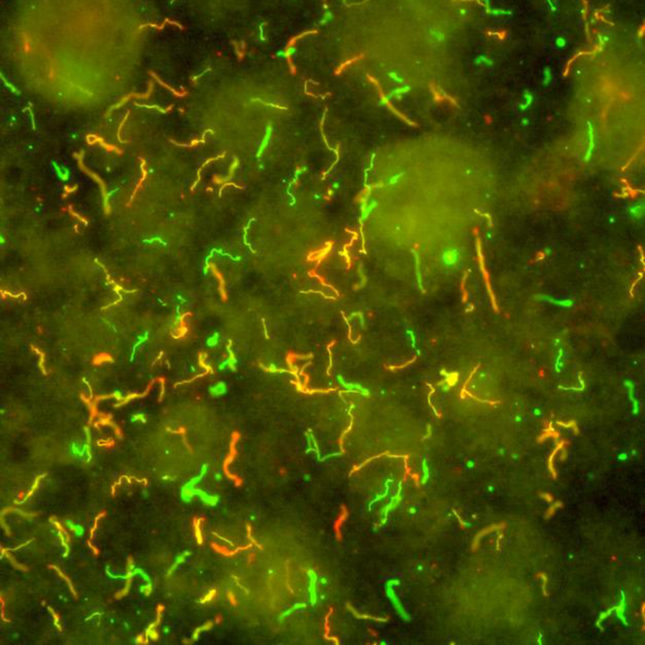 <span class="entry-title-primary">Borrelia burgdorferi Infection Market Global Industry Trends, Share and 2025</span> <span class="entry-subtitle">Borrelia burgdorferi Infection Market</span><span class="rating-result after_title mr-filter rating-result-30645">			<span class="no-rating-results-text">No ratings yet.</span>		</span>