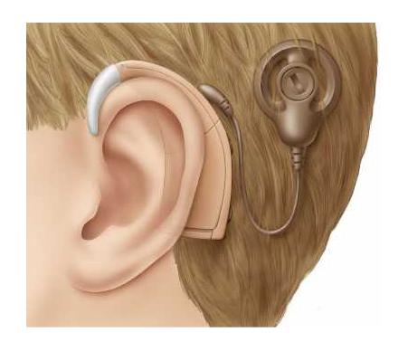 <span class="entry-title-primary">Global Hearing Implants and Biomaterials Market Research Report 2019</span> <span class="entry-subtitle">Hearing Implants and Biomaterials Market Report, Analysis, and Forecast to 2024</span><span class="rating-result after_title mr-filter rating-result-28580">	<span class="mr-star-rating">			    <i class="fa fa-star mr-star-full"></i>	    	    <i class="fa fa-star mr-star-full"></i>	    	    <i class="fa fa-star mr-star-full"></i>	    	    <i class="fa fa-star mr-star-full"></i>	    	    <i class="fa fa-star mr-star-full"></i>	    </span><span class="star-result">	5/5</span>			<span class="count">				(1)			</span>			</span>