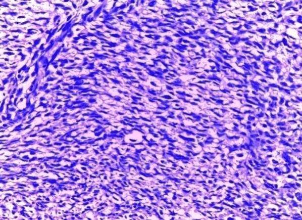 <span class="entry-title-primary">Neurofibrosarcoma Market Research Report Study By Product and  Forecast To 2028</span> <span class="entry-subtitle">Neurofibrosarcoma Market Industry Size, Demand, Trends</span><span class="rating-result after_title mr-filter rating-result-27036">	<span class="mr-star-rating">			    <i class="fa fa-star mr-star-full"></i>	    	    <i class="fa fa-star mr-star-full"></i>	    	    <i class="fa fa-star mr-star-full"></i>	    	    <i class="fa fa-star mr-star-full"></i>	    	    <i class="fa fa-star mr-star-full"></i>	    </span><span class="star-result">	5/5</span>			<span class="count">				(1)			</span>			</span>