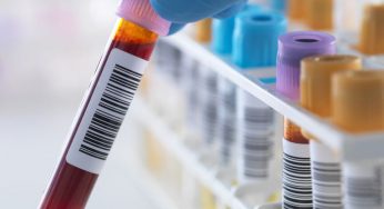 Nucleic Acid Testing Market: Industry Analysis, Share, Size, Growth and Forecast 2019 – 2025