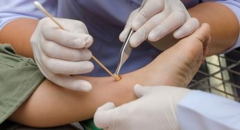 Total Ankle Replacement Market Size, Growth, Trends, Share and Analysis