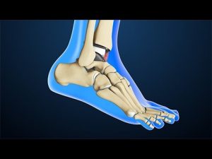 <span class="entry-title-primary">Total Ankle Replacement Market – Analysis and future growth  by 2019-2025</span> <span class="entry-subtitle">Global Total Ankle Replacement Market Research</span>