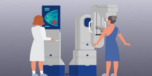 Mammography Market: Global Industry Analysis and Opportunity Assessment