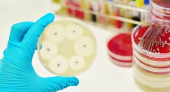 Global Antimicrobial Susceptibility Test Market Forecast to 2019-2025