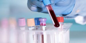 <span class="entry-title-primary">Blood Collection, Processing, Management Devices, and Consumables Market Forecast 2019-2025</span> <span class="entry-subtitle">Global Blood Collection, Processing, Management Devices, and Consumables Market</span>