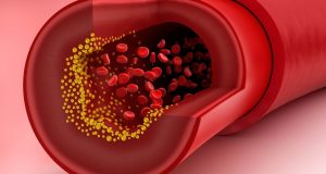 Cholesterol Market Size, Growth, Trends, Share and Analysis