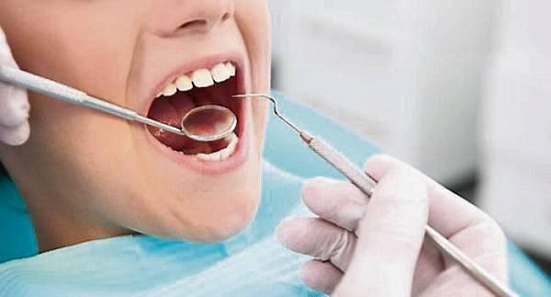 <span class="entry-title-primary">Dental Bonding Agent Market Report (2019-2025) | demand Analysis,</span> <span class="entry-subtitle">Global Dental Bonding Agent Market</span><span class="rating-result after_title mr-filter rating-result-32316">	<span class="mr-star-rating">			    <i class="fa fa-star mr-star-full"></i>	    	    <i class="fa fa-star mr-star-full"></i>	    	    <i class="fa fa-star mr-star-full"></i>	    	    <i class="fa fa-star mr-star-full"></i>	    	    <i class="fa fa-star mr-star-full"></i>	    </span><span class="star-result">	5/5</span>			<span class="count">				(1)			</span>			</span>