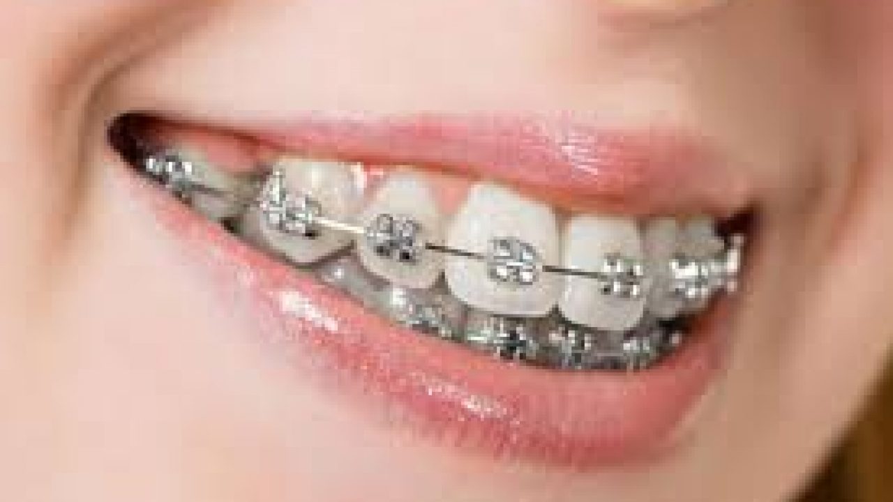 <span class="entry-title-primary">Dental liners Market Size, Growth, Trends and 2025 Forecast Report</span> <span class="entry-subtitle">Global Dental liners Market Report</span><span class="rating-result after_title mr-filter rating-result-33582">	<span class="mr-star-rating">			    <i class="fa fa-star mr-star-full"></i>	    	    <i class="fa fa-star mr-star-full"></i>	    	    <i class="fa fa-star mr-star-full"></i>	    	    <i class="fa fa-star mr-star-full"></i>	    	    <i class="fa fa-star mr-star-full"></i>	    </span><span class="star-result">	5/5</span>			<span class="count">				(1)			</span>			</span>