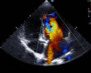 <span class="entry-title-primary">Echocardiography Market: Analysis, Share, Size, Growth,  and Forecast 2019</span> <span class="entry-subtitle">Global Echocardiography Market</span>