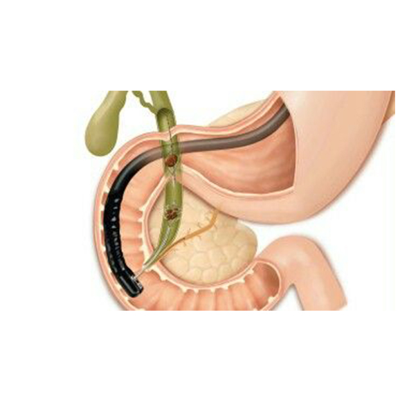 <span class="entry-title-primary">Endoscopic Retrograde Cholangiopancreatography Market Overview, Growth Analysis</span> <span class="entry-subtitle">Global Endoscopic Retrograde Cholangiopancreatography Market</span><span class="rating-result after_title mr-filter rating-result-32820">	<span class="mr-star-rating">			    <i class="fa fa-star mr-star-full"></i>	    	    <i class="fa fa-star mr-star-full"></i>	    	    <i class="fa fa-star mr-star-full"></i>	    	    <i class="fa fa-star mr-star-full"></i>	    	    <i class="fa fa-star mr-star-full"></i>	    </span><span class="star-result">	5/5</span>			<span class="count">				(1)			</span>			</span>