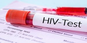 HIV Diagnosis and Treatment Market Size, Growth, Trends, Share and Analysis