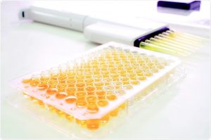 <span class="entry-title-primary">High Throughput Screening Market 2019 Global Industry Analysis, by Size, Share, Growth, Trends</span> <span class="entry-subtitle">Global High Throughput Screening Market</span>