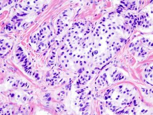 <span class="entry-title-primary">Insulinoma Market Size, Industry Growth Analysis And Forecast: 2024</span> <span class="entry-subtitle">Global Insulinoma Market Research:</span>