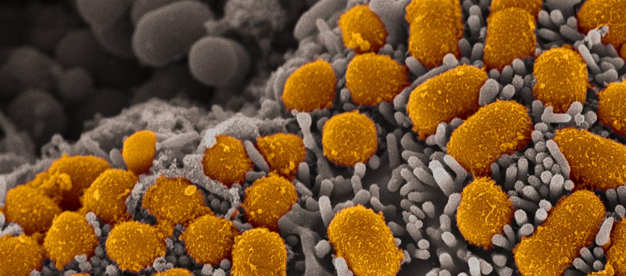 MRSA Antibiotics Market Size, Growth, Trends, Share and Analysis<span class="rating-result after_title mr-filter rating-result-33249">			<span class="no-rating-results-text">No ratings yet.</span>		</span>