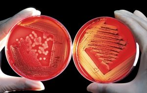 <span class="entry-title-primary">Microbiology Testing/Clinical Microbiology Market Size – Industry Growth Report 2025</span> <span class="entry-subtitle">Microbiology Testing/Clinical Microbiology Market Demand, Share Analysis </span>