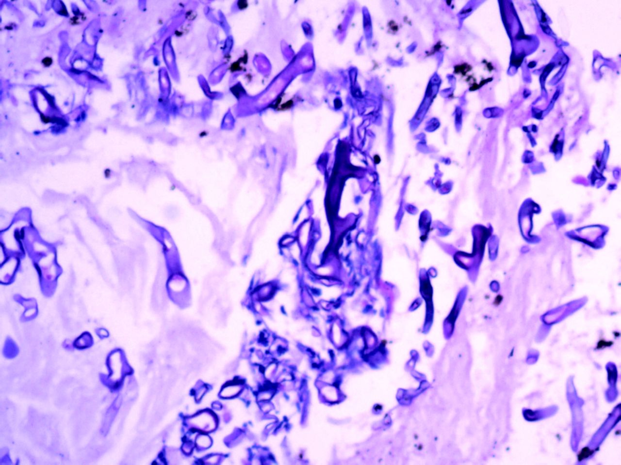 <span class="entry-title-primary">Mucormycosis Market Latest Trend, Growth, Size, Application  And Forecast 2024</span> <span class="entry-subtitle">Mucormycosis Market Trends Forecast to 2019</span><span class="rating-result after_title mr-filter rating-result-32858">	<span class="mr-star-rating">			    <i class="fa fa-star mr-star-full"></i>	    	    <i class="fa fa-star mr-star-full"></i>	    	    <i class="fa fa-star mr-star-full"></i>	    	    <i class="fa fa-star mr-star-full"></i>	    	    <i class="fa fa-star mr-star-full"></i>	    </span><span class="star-result">	5/5</span>			<span class="count">				(1)			</span>			</span>