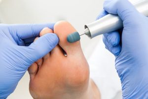 <span class="entry-title-primary">Podiatry Market | Industry Report, 2019-2025</span> <span class="entry-subtitle">Podiatry Market by Types, Application, Technology</span>