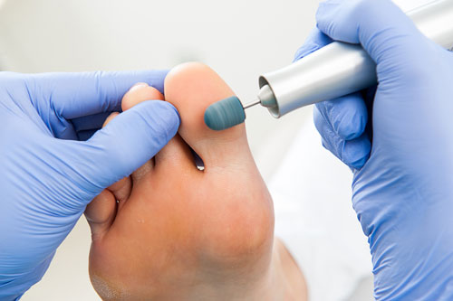 <span class="entry-title-primary">Podiatry Market | Industry Report, 2019-2025</span> <span class="entry-subtitle">Podiatry Market by Types, Application, Technology</span><span class="rating-result after_title mr-filter rating-result-33338">	<span class="mr-star-rating">			    <i class="fa fa-star mr-star-full"></i>	    	    <i class="fa fa-star mr-star-full"></i>	    	    <i class="fa fa-star mr-star-full"></i>	    	    <i class="fa fa-star mr-star-full"></i>	    	    <i class="fa fa-star mr-star-full"></i>	    </span><span class="star-result">	5/5</span>			<span class="count">				(1)			</span>			</span>