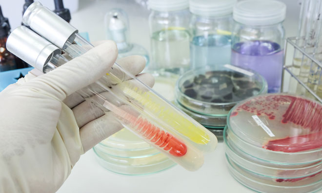 <span class="entry-title-primary">Rapid Microbiology Testing Market Global Industry Size, Demand, Trends and 2024</span> <span class="entry-subtitle">Global Rapid Microbiology Testing Market Report</span><span class="rating-result after_title mr-filter rating-result-34027">	<span class="mr-star-rating">			    <i class="fa fa-star mr-star-full"></i>	    	    <i class="fa fa-star mr-star-full"></i>	    	    <i class="fa fa-star mr-star-full"></i>	    	    <i class="fa fa-star mr-star-full"></i>	    	    <i class="fa fa-star mr-star-full"></i>	    </span><span class="star-result">	5/5</span>			<span class="count">				(1)			</span>			</span>