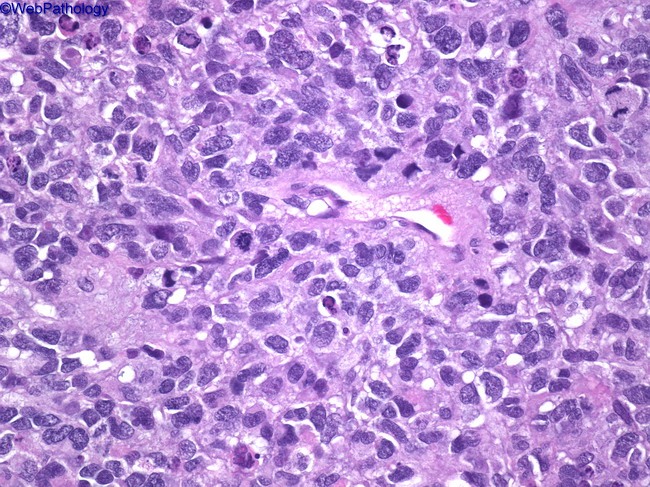 <span class="entry-title-primary">Rhabdomyosarcoma Market Global Size, Share, Supply, Demand</span> <span class="entry-subtitle">Rhabdomyosarcoma Market Supply, Demand, Segments and Forecast</span><span class="rating-result after_title mr-filter rating-result-33411">	<span class="mr-star-rating">			    <i class="fa fa-star mr-star-full"></i>	    	    <i class="fa fa-star mr-star-full"></i>	    	    <i class="fa fa-star mr-star-full"></i>	    	    <i class="fa fa-star mr-star-full"></i>	    	    <i class="fa fa-star mr-star-full"></i>	    </span><span class="star-result">	5/5</span>			<span class="count">				(1)			</span>			</span>