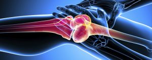 <span class="entry-title-primary">Stem Cell Therapy for Osteoarthritis Market Growth, Trends and Demands Research</span> <span class="entry-subtitle">Stem Cell Therapy for Osteoarthritis Market Insight, Analysis</span>