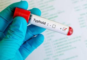 Typhoid Vaccine Market Size, Growth, Trends, Share and Analysis