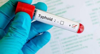 Typhoid Vaccine Market Size, Growth, Trends, Share and Analysis