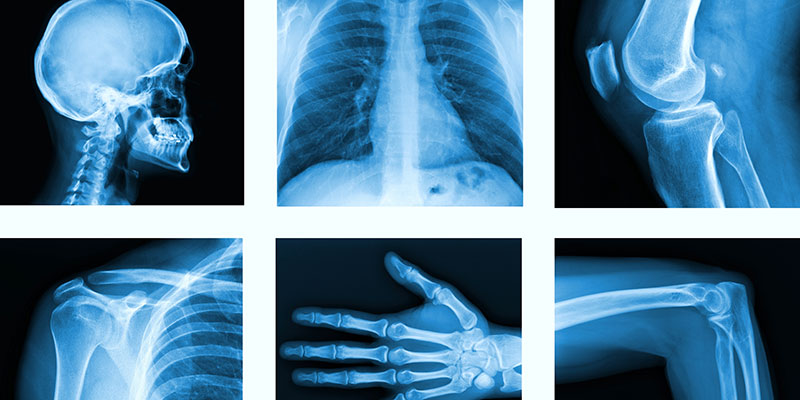 <span class="entry-title-primary">X Ray Market | Industry Analysis and Forecast by 2024</span> <span class="entry-subtitle">Global X Ray Market Report</span><span class="rating-result after_title mr-filter rating-result-34007">	<span class="mr-star-rating">			    <i class="fa fa-star mr-star-full"></i>	    	    <i class="fa fa-star mr-star-full"></i>	    	    <i class="fa fa-star mr-star-full"></i>	    	    <i class="fa fa-star mr-star-full"></i>	    	    <i class="fa fa-star mr-star-full"></i>	    </span><span class="star-result">	5/5</span>			<span class="count">				(1)			</span>			</span>